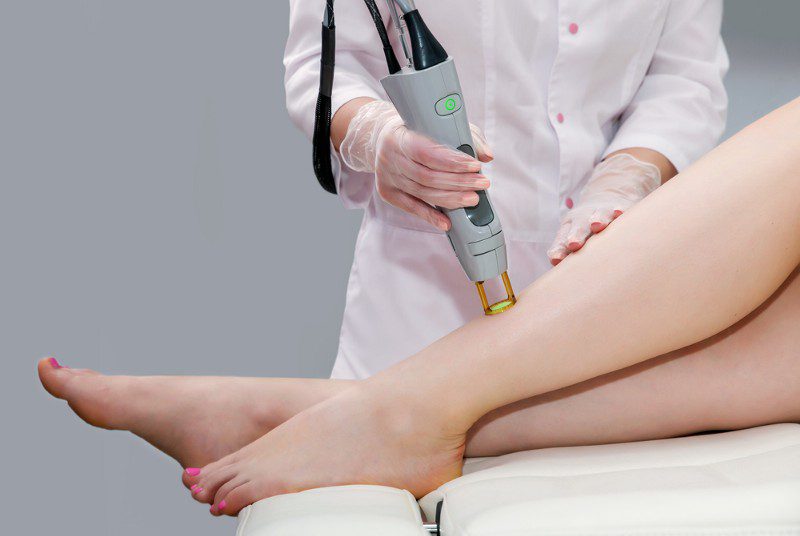 We Answer Every Question You’ve Ever Had About Laser Hair Removal